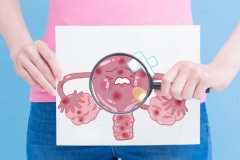 多囊卵巢綜合征對懷孕的影響？多囊一定要促排嗎？